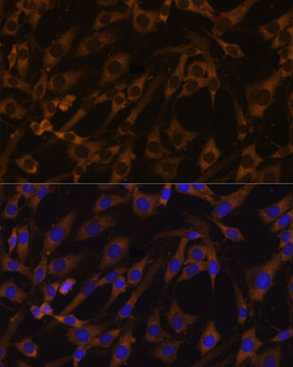 Immunofluorescence analysis of C6 cells using EIF5B Polyclonal Antibody at dilution of  1:100. Blue: DAPI for nuclear staining.