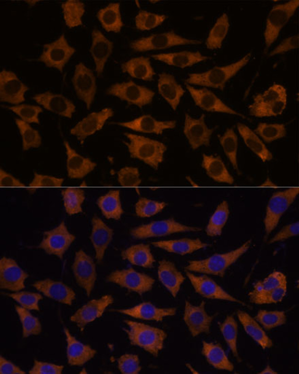 Immunofluorescence analysis of L929 cells using EIF5B Polyclonal Antibody at dilution of  1:100. Blue: DAPI for nuclear staining.