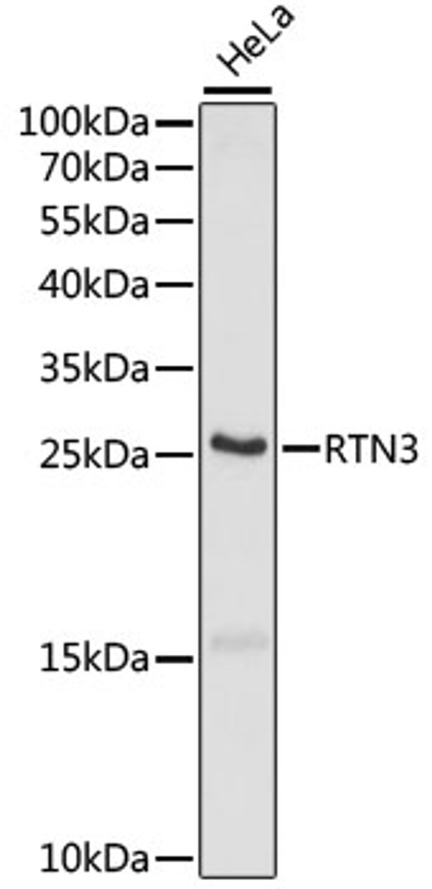 Western blot analysis of extracts of HeLa cells using RTN3 Polyclonal Antibody at dilution of 1:1000.