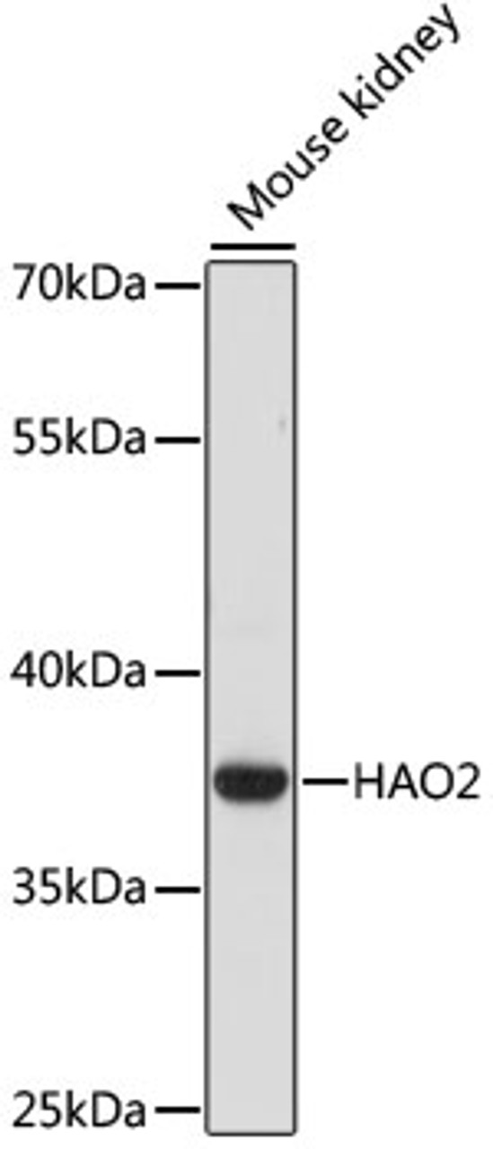 Western blot analysis of extracts of Mouse kidney using HAO2 Polyclonal Antibody at dilution of 1:1000.