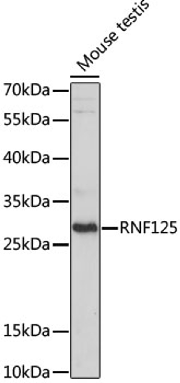 Western blot analysis of extracts of Mouse testis using RNF125 Polyclonal Antibody at dilution of 1:1000.