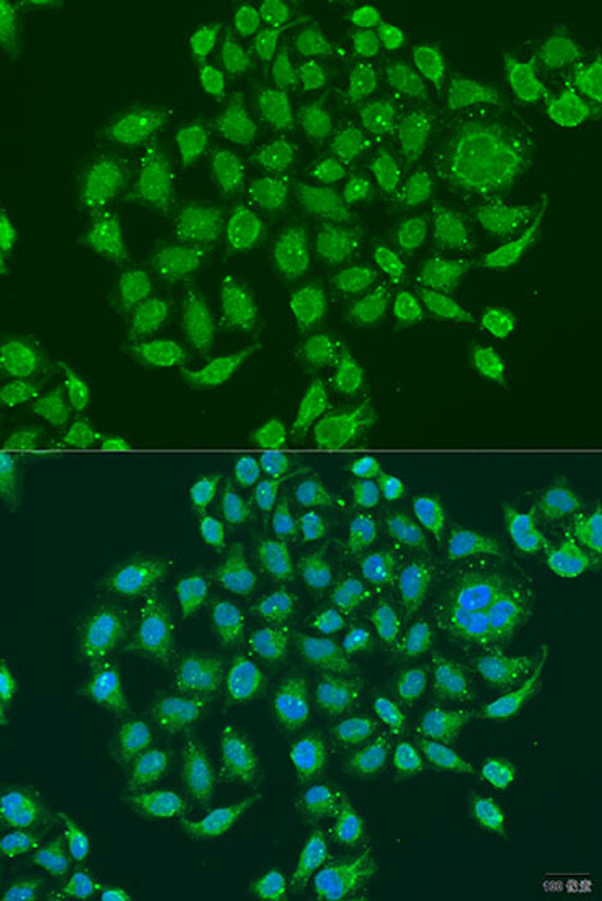 Immunofluorescence analysis of U2OS cells using PRDM10 Polyclonal Antibody at dilution of  1:100. Blue: DAPI for nuclear staining.