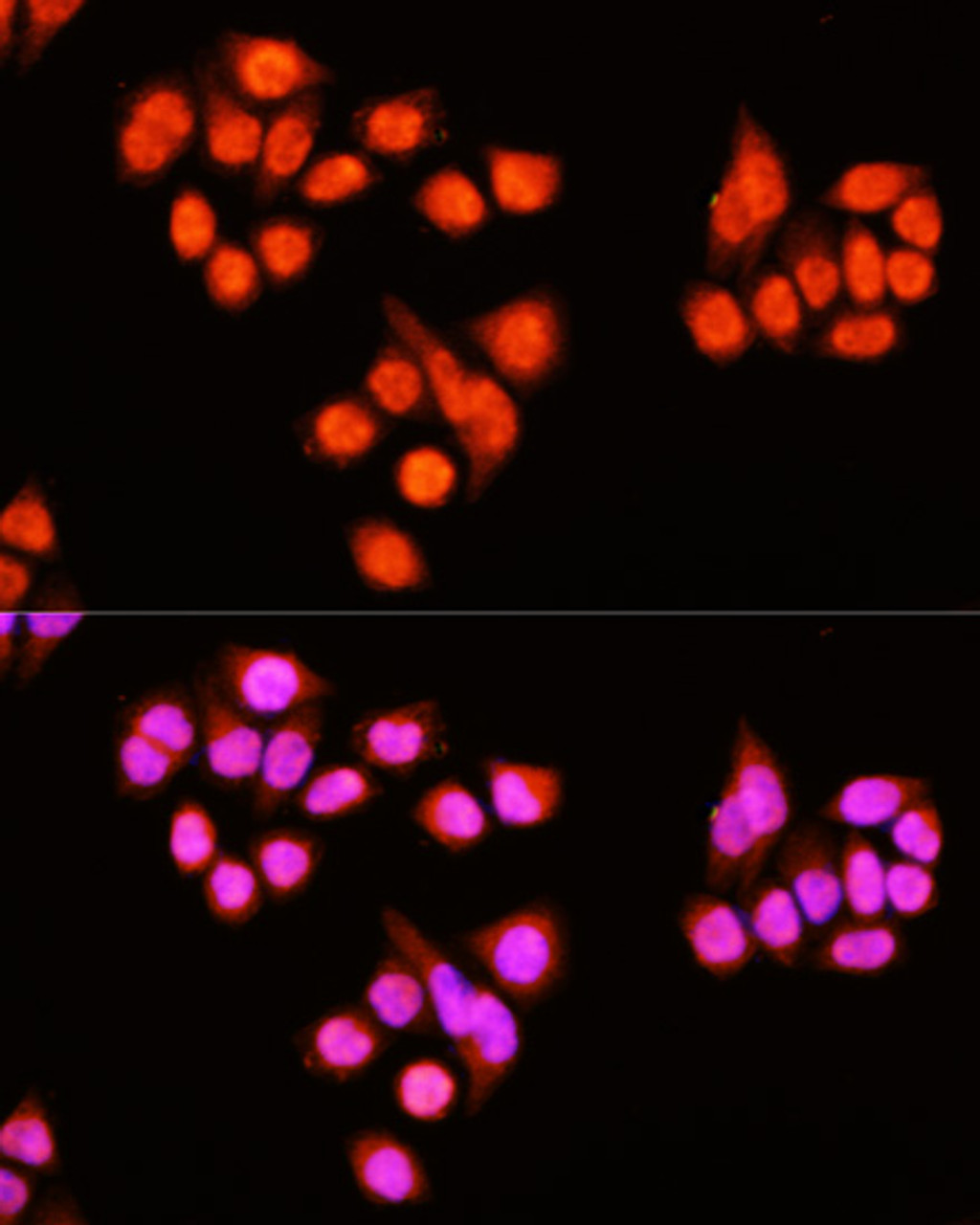Immunofluorescence analysis of Hela cells using ZNF408 Polyclonal Antibody at dilution of  1:100 (40x lens). Blue: DAPI for nuclear staining.
