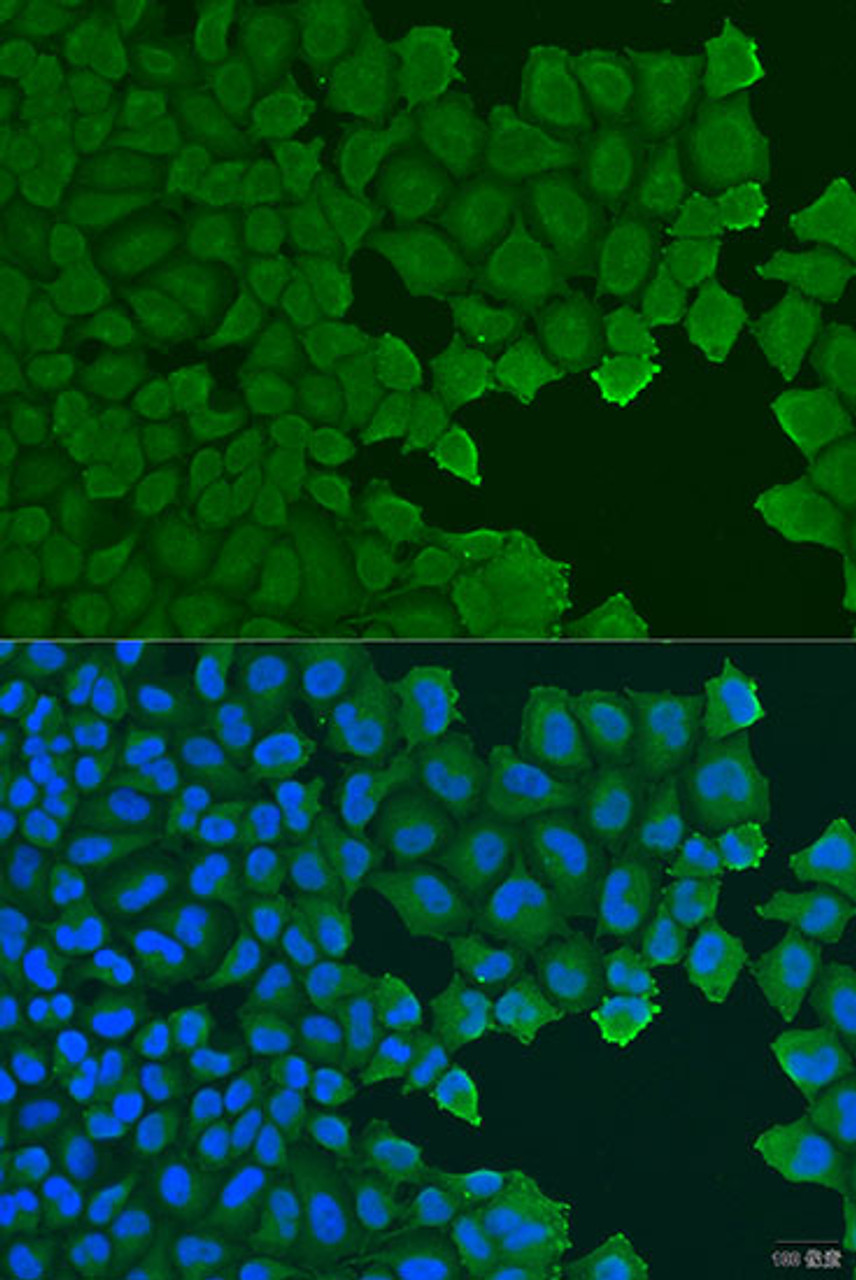 Immunofluorescence analysis of U2OS cells using TCTN2 Polyclonal Antibody at dilution of  1:100. Blue: DAPI for nuclear staining.