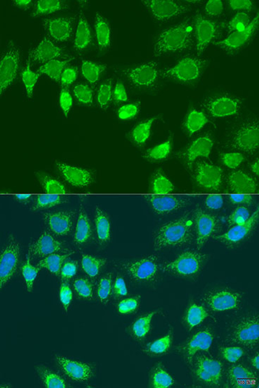 Immunofluorescence analysis of U2OS cells using L2HGDH Polyclonal Antibody at dilution of  1:100. Blue: DAPI for nuclear staining.