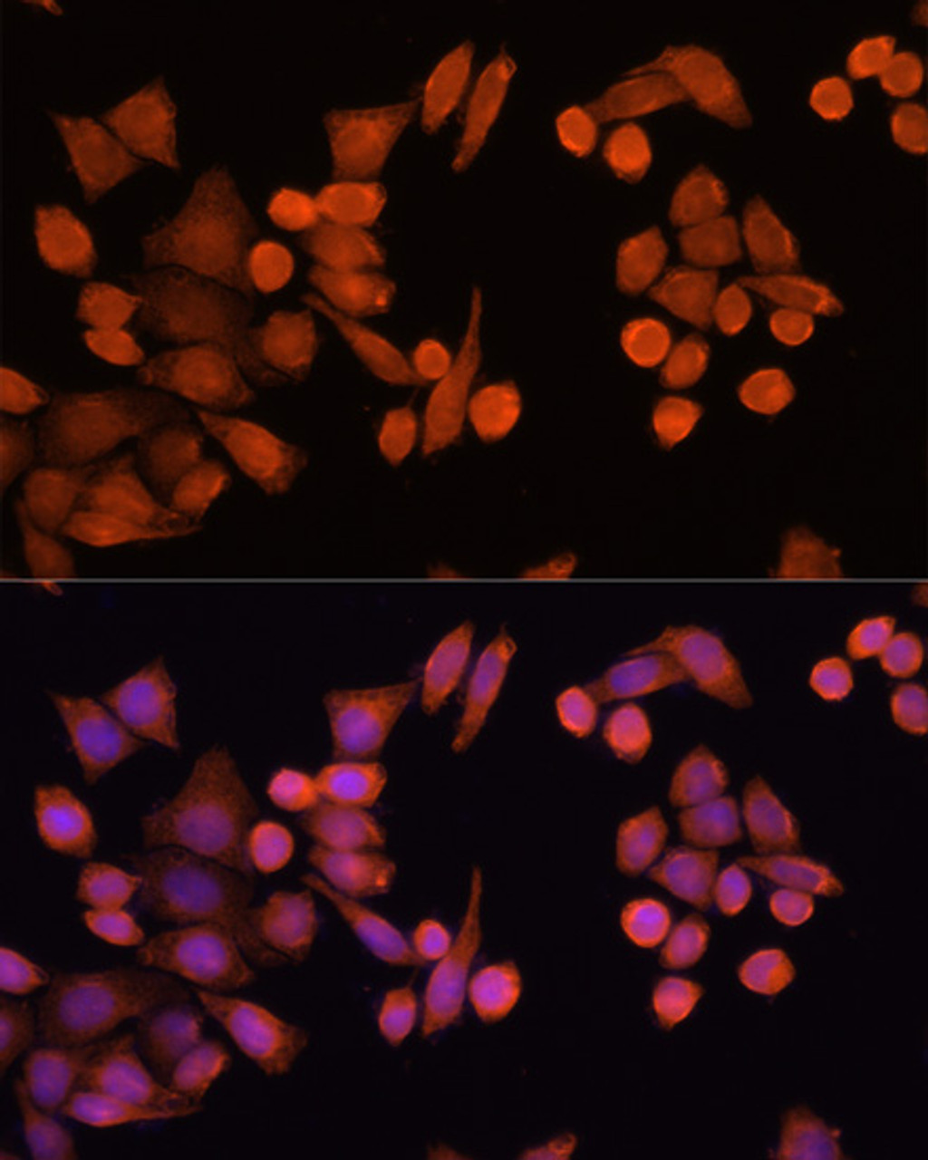 Immunofluorescence analysis of Hela cells using PLA2G4D Polyclonal Antibody at dilution of  1:100 (40x lens). Blue: DAPI for nuclear staining.