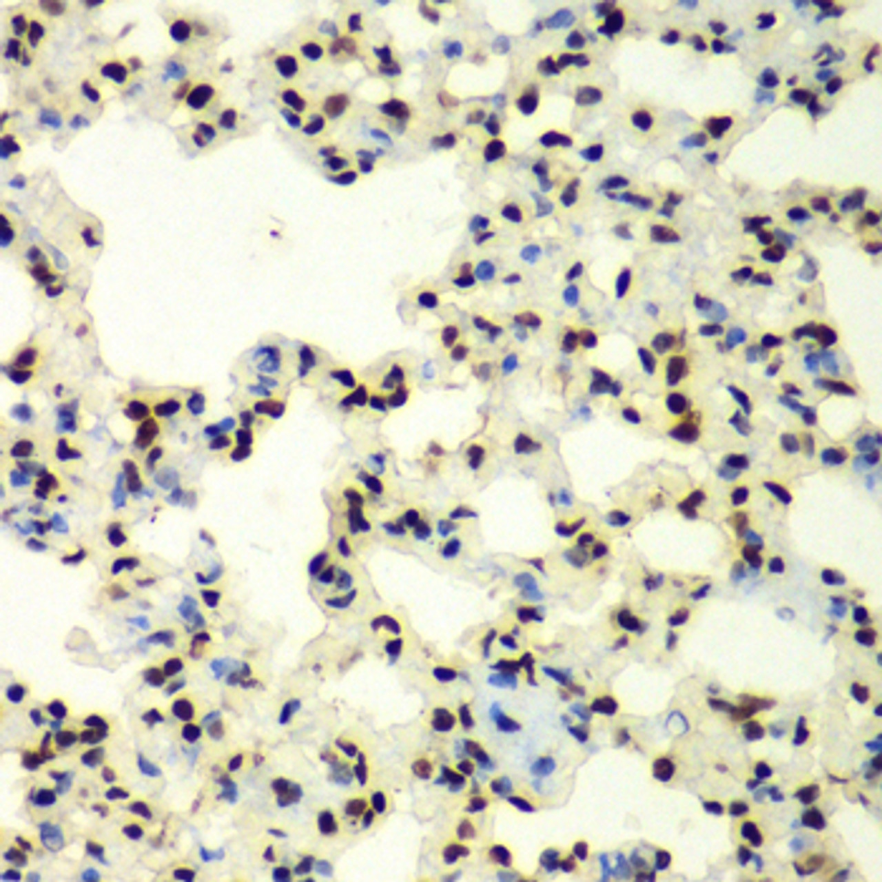 Immunohistochemistry of paraffin-embedded Rat lung using SUMO2 Polyclonal Antibody at dilution of  1:100 (40x lens).