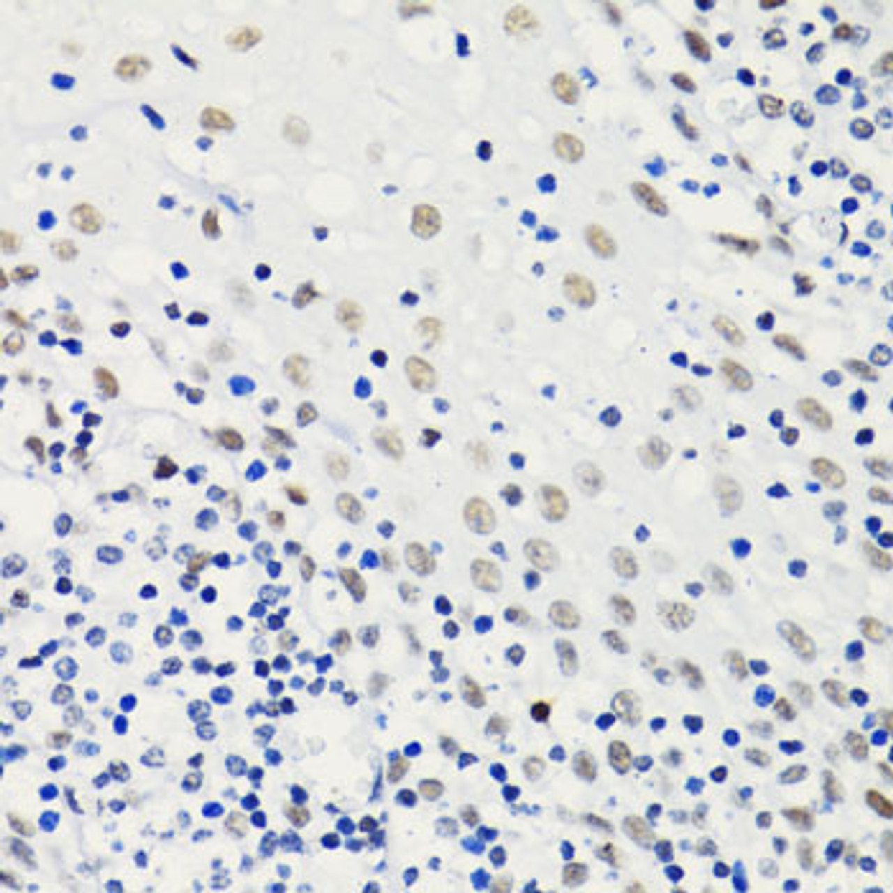 Immunohistochemistry of paraffin-embedded Human tonsil using Acetyl-Histone H4-K5 Polyclonal Antibody at dilution of  1:100 (40x lens).