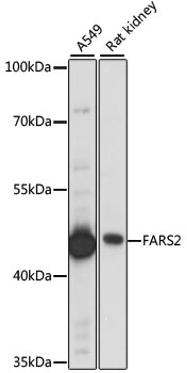 Western blot analysis of extracts of various cell lines using FARS2 Polyclonal Antibody at dilution of 1:1000.