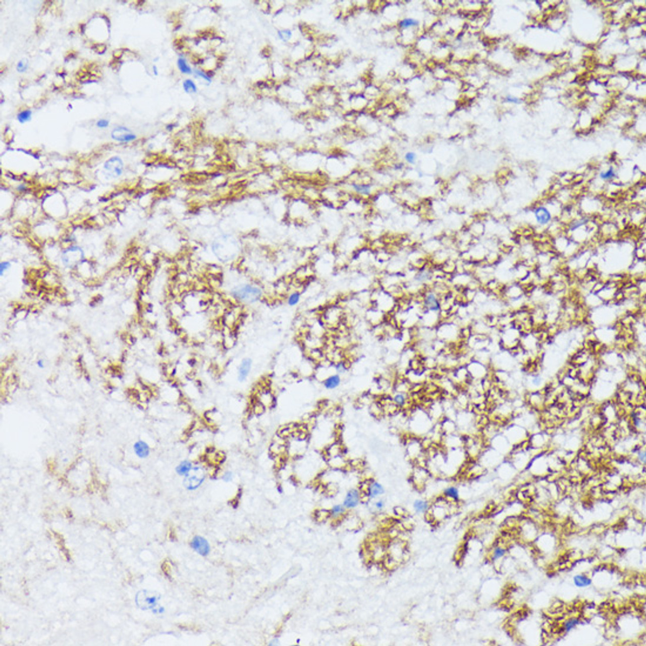 Immunohistochemistry of paraffin-embedded Mouse spinal cord using CTNNA2 Polyclonal Antibody at dilution of  1:100 (40x lens).
