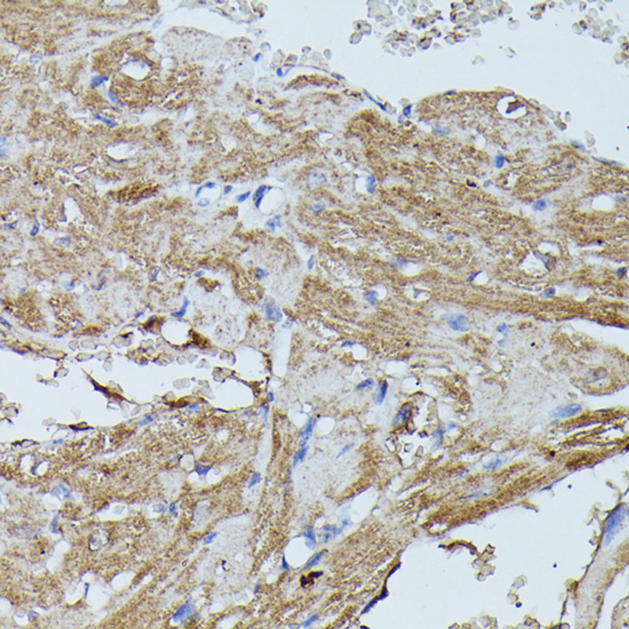 Immunohistochemistry of paraffin-embedded Mouse heart using FLII Polyclonal Antibody at dilution of  1:100 (40x lens).