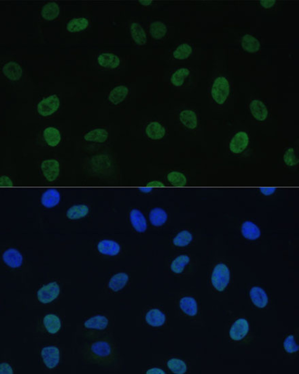 Immunofluorescence analysis of U-2 OS cells using GTF2E1 Polyclonal Antibody at dilution of  1:100 (40x lens). Blue: DAPI for nuclear staining.