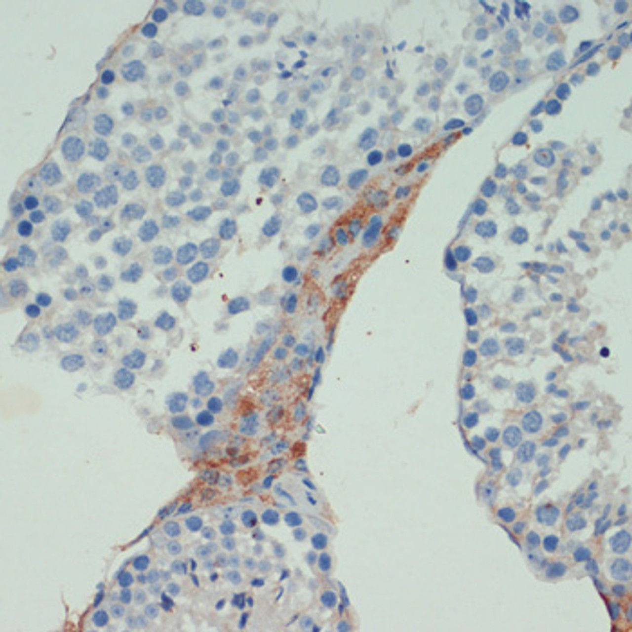 Immunohistochemistry of paraffin-embedded Mouse testis using KIF5B Polyclonal Antibody at dilution of  1:200 (40x lens).