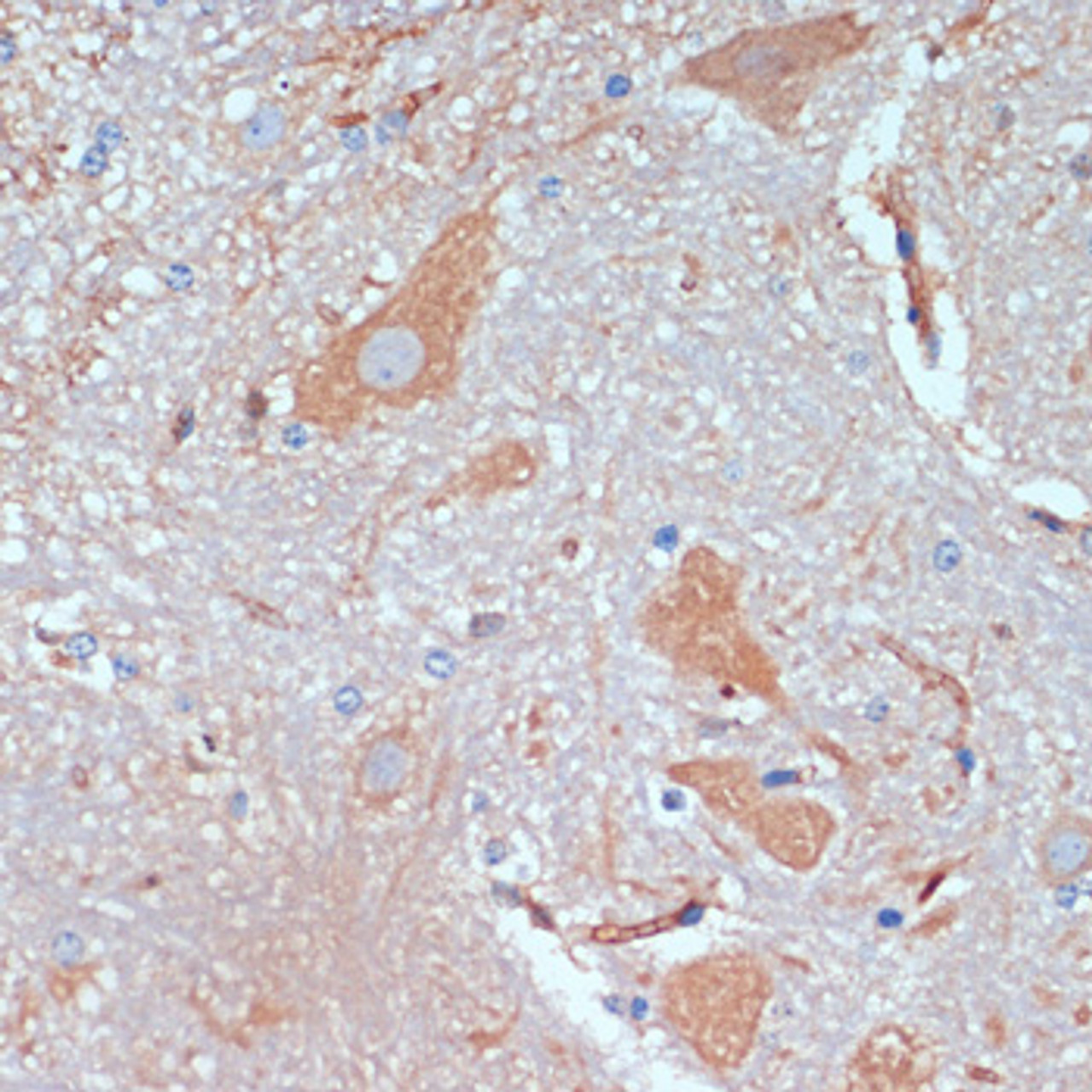Immunohistochemistry of paraffin-embedded Mouse spinal cord using KIF5B Polyclonal Antibody at dilution of  1:200 (40x lens).