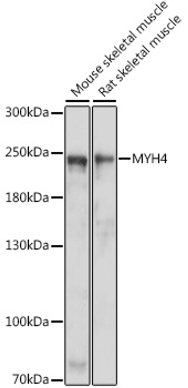 Western blot analysis of extracts of various cell lines using MYH4 Polyclonal Antibody at dilution of 1:1000.