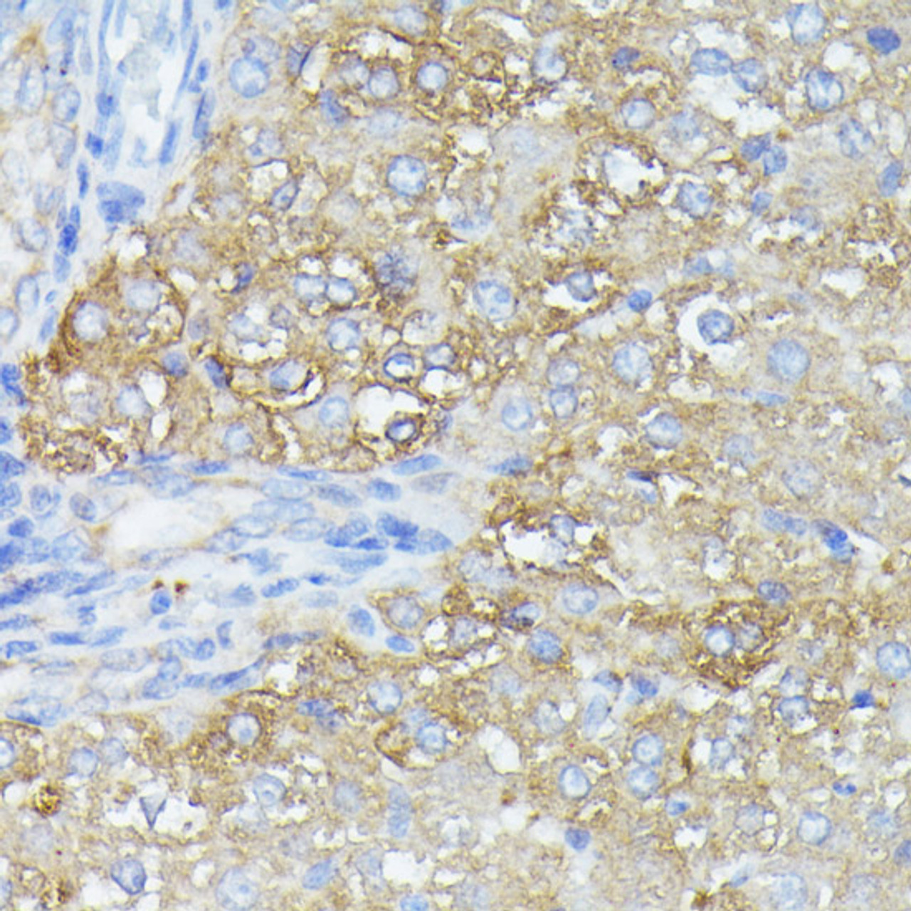 Immunohistochemistry of paraffin-embedded Rat liver using PFDN4 Polyclonal Antibody at dilution of  1:100 (40x lens).