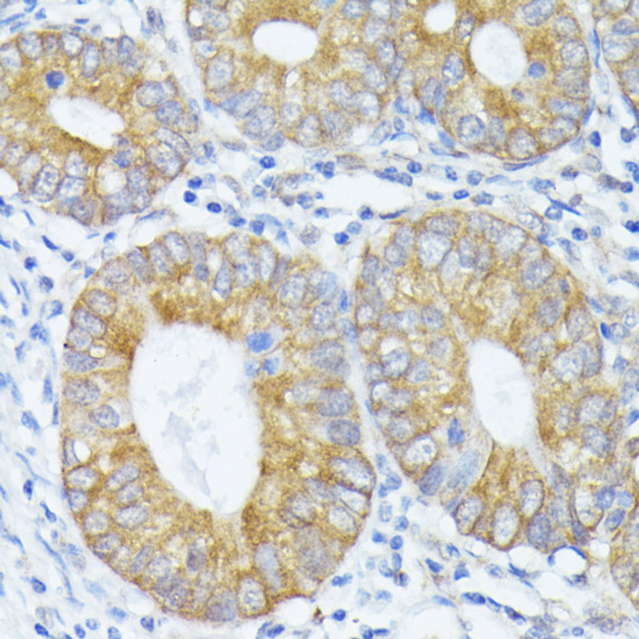Immunohistochemistry of paraffin-embedded Human colon using PFDN4 Polyclonal Antibody at dilution of  1:100 (40x lens).