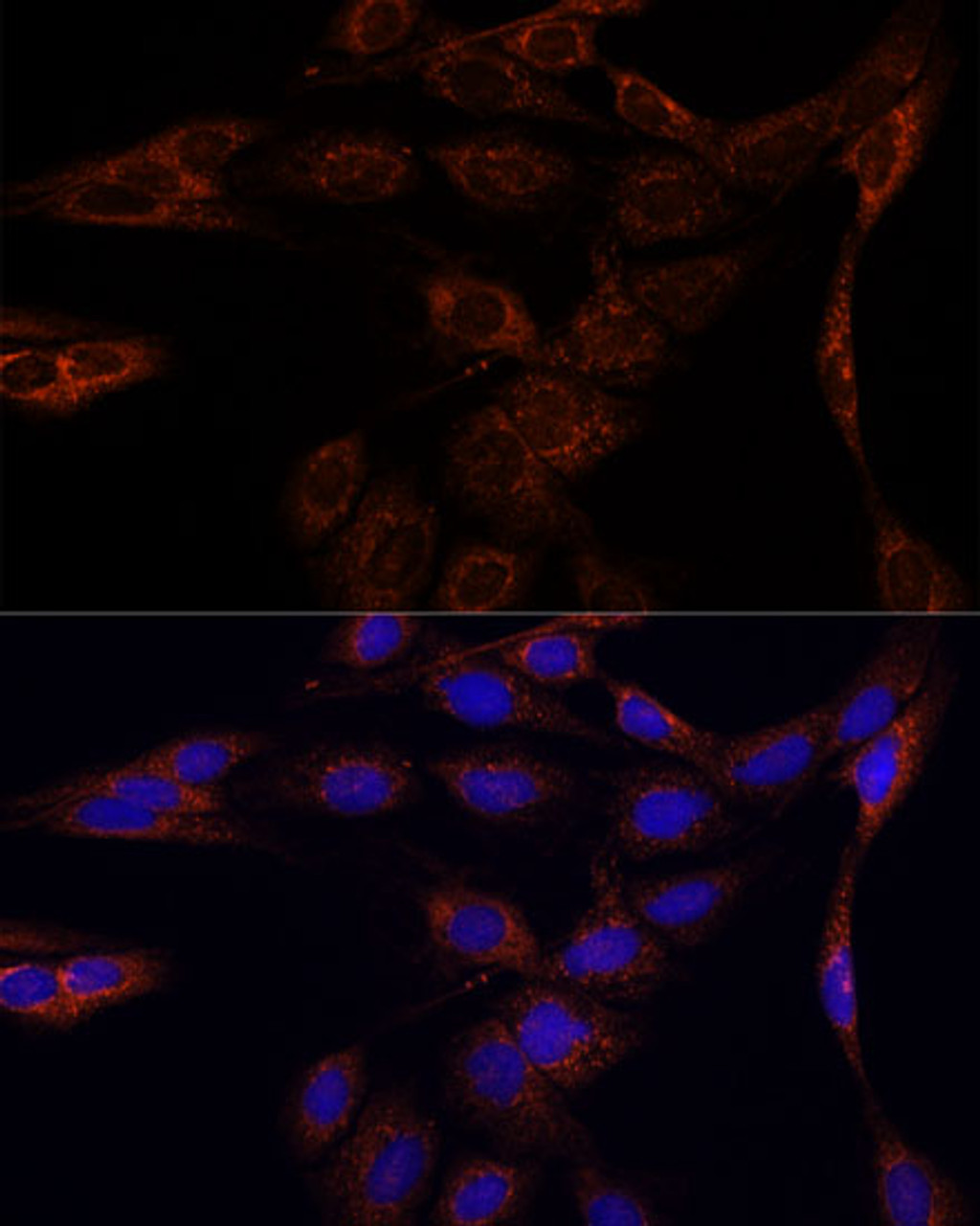 Immunofluorescence analysis of C6 cells using PFDN4 Polyclonal Antibody at dilution of  1:100. Blue: DAPI for nuclear staining.