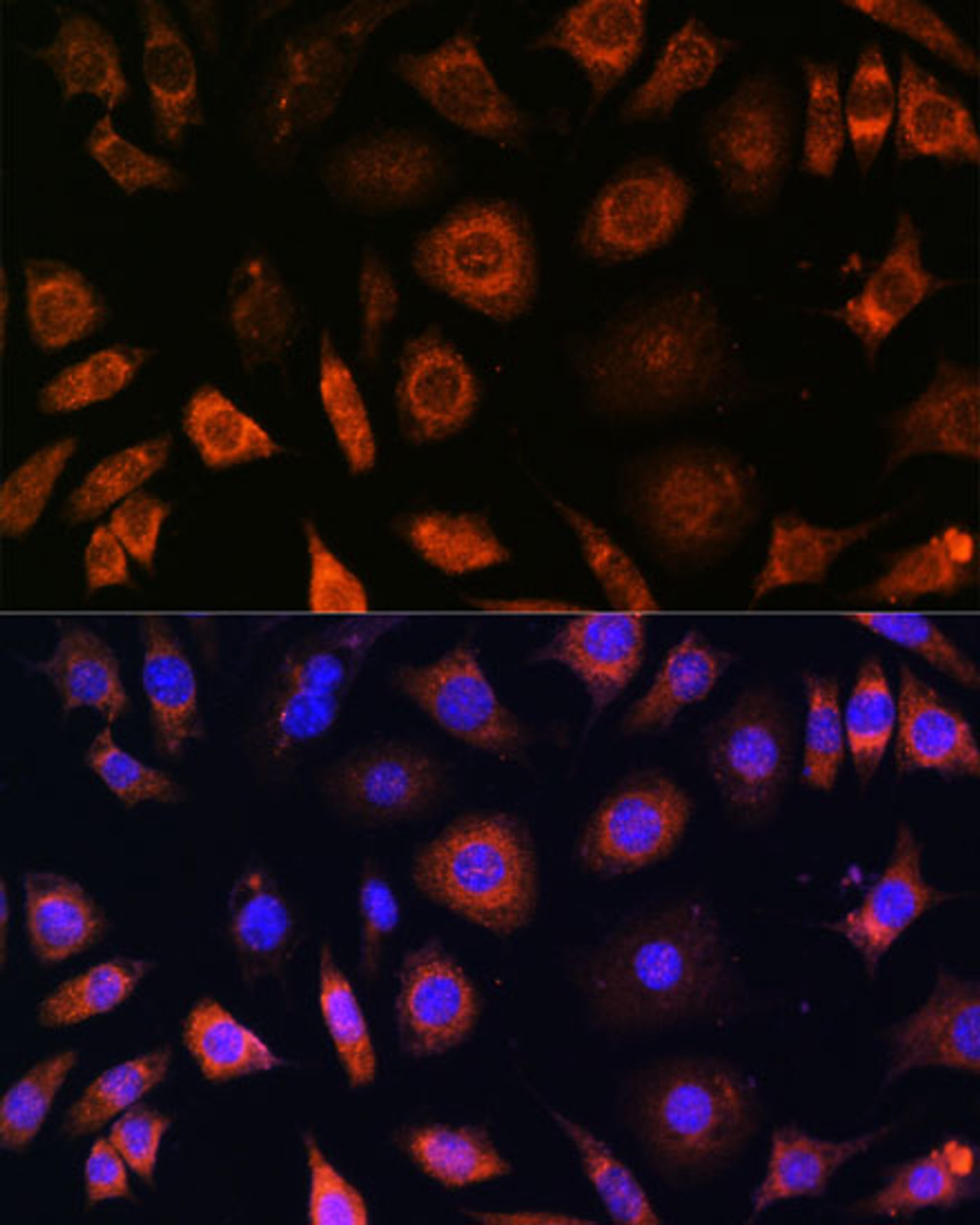 Immunofluorescence analysis of L929 cells using PFDN4 Polyclonal Antibody at dilution of  1:100. Blue: DAPI for nuclear staining.