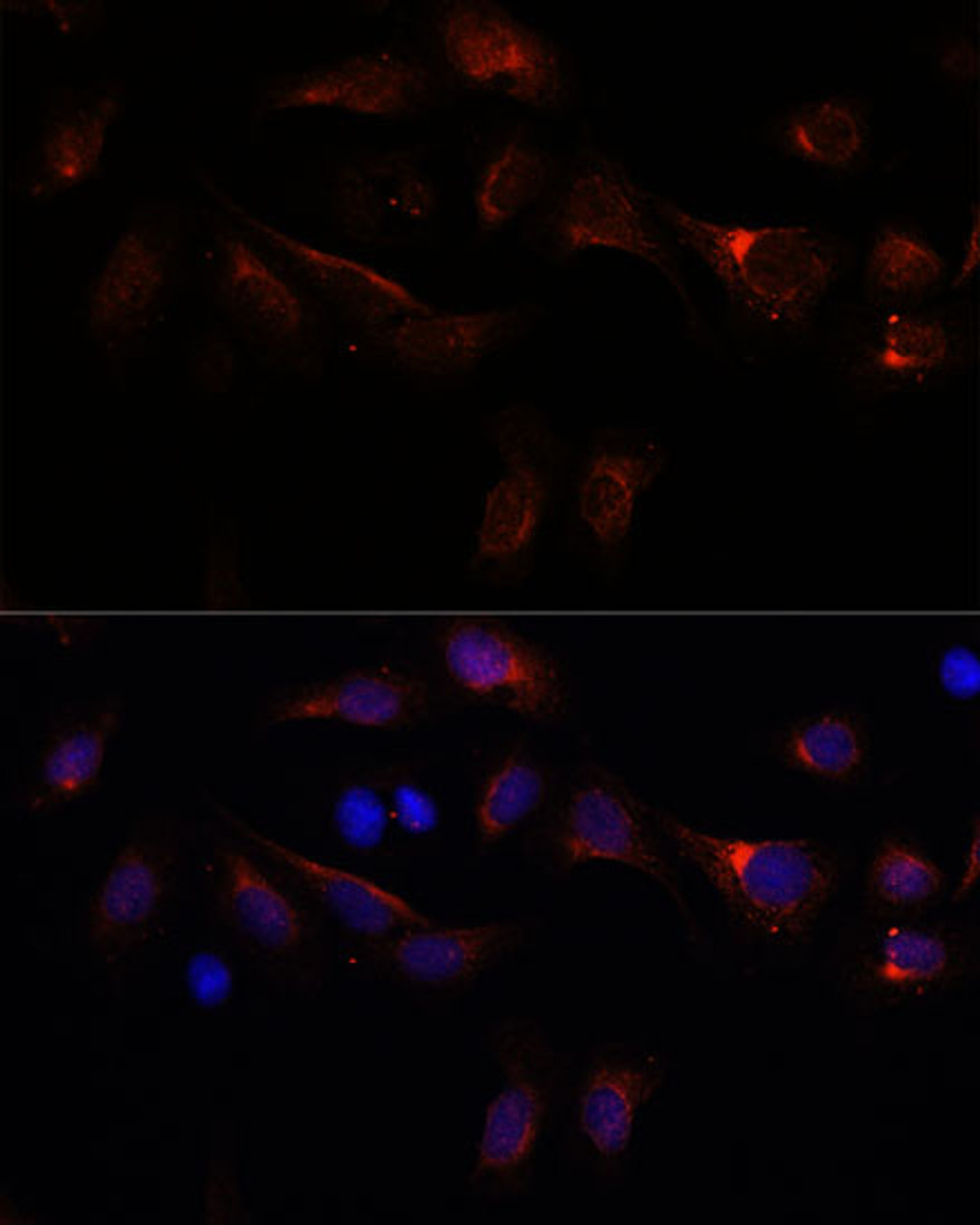 Immunofluorescence analysis of U-2 OS cells using PFDN4 Polyclonal Antibody at dilution of  1:100. Blue: DAPI for nuclear staining.