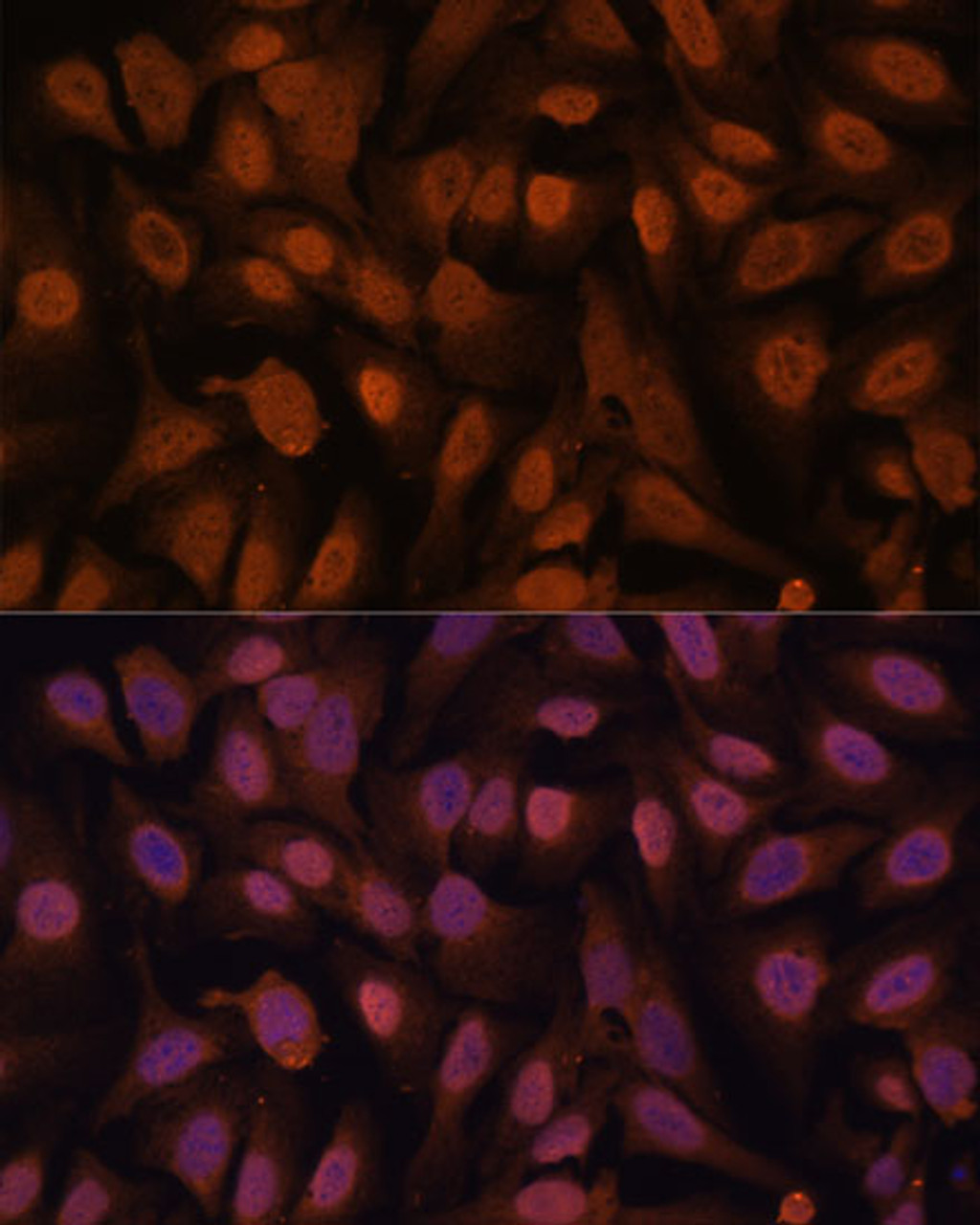 Immunofluorescence analysis of U-2 OS cells using ZNF131 Polyclonal Antibody at dilution of  1:100. Blue: DAPI for nuclear staining.