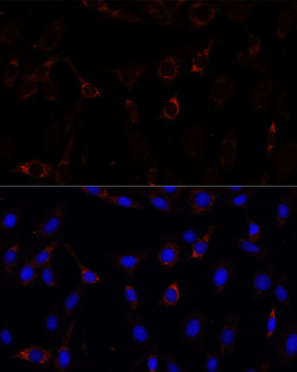 Immunofluorescence analysis of C6 cells using RNF112 Polyclonal Antibody at dilution of  1:100. Blue: DAPI for nuclear staining.