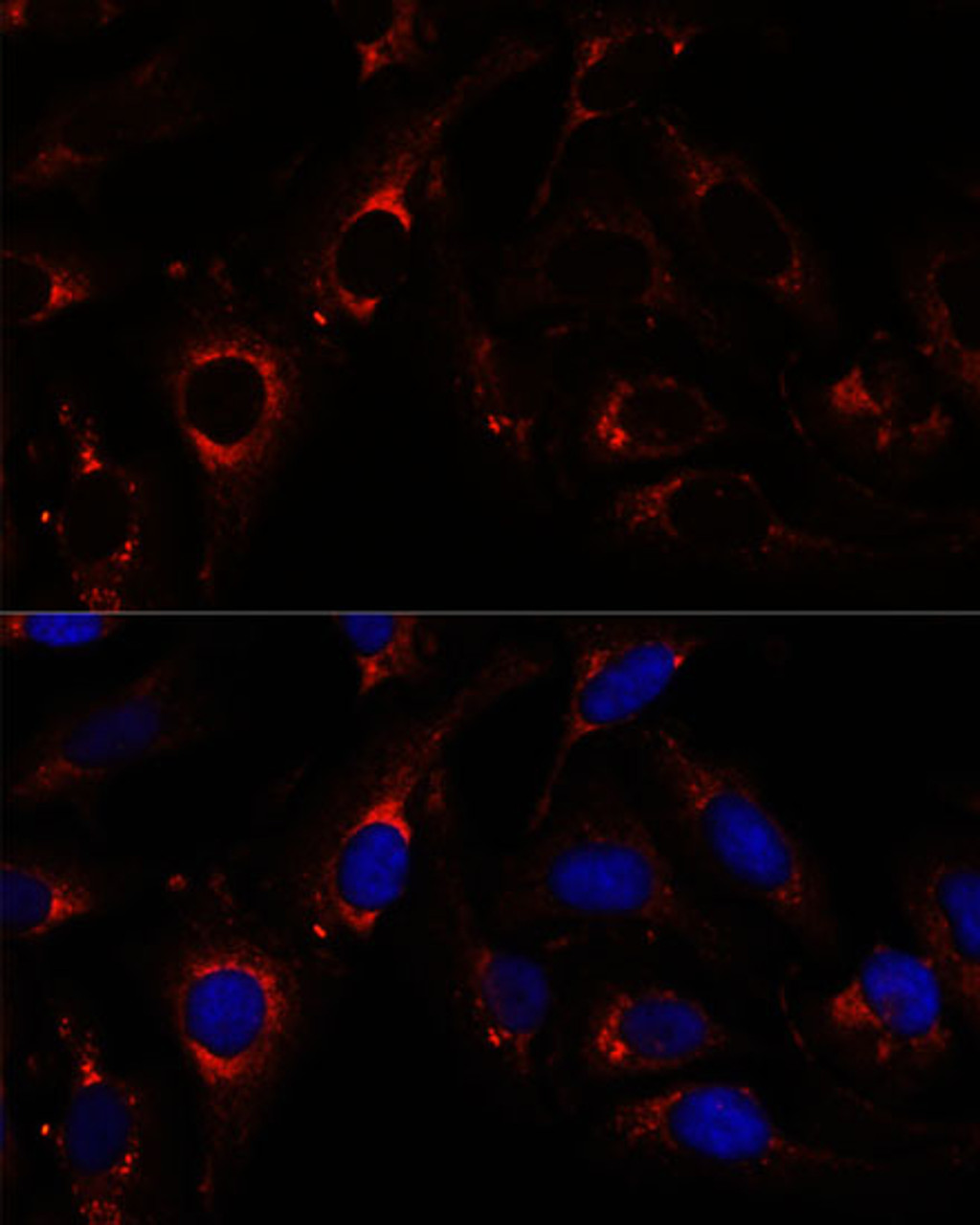 Immunofluorescence analysis of U-2 OS cells using RNF112 Polyclonal Antibody at dilution of  1:100. Blue: DAPI for nuclear staining.