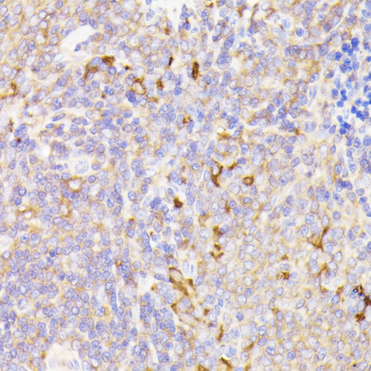 Immunohistochemistry of paraffin-embedded Rat spleen using PSMG1 Polyclonal Antibody at dilution of  1:100 (40x lens).