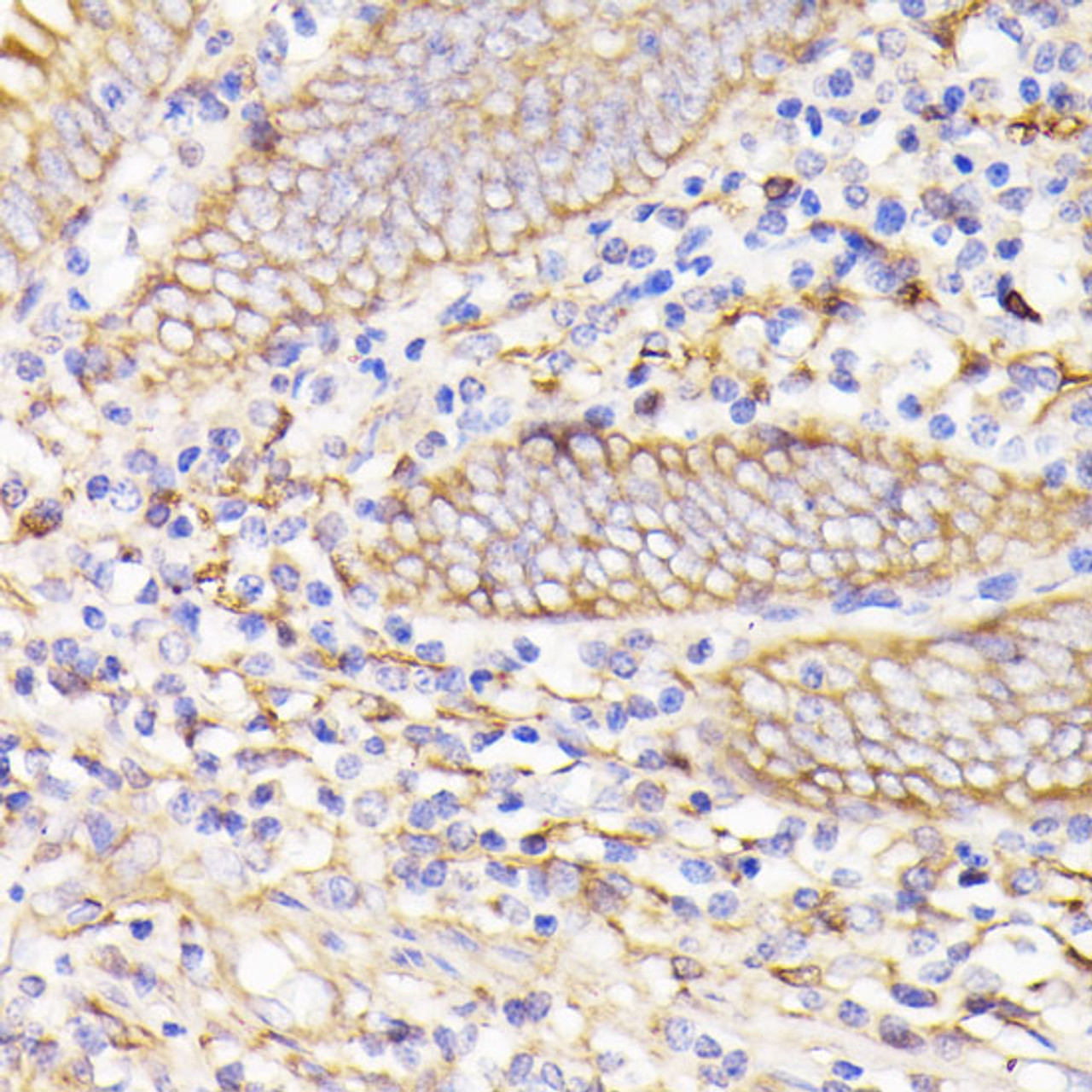 Immunohistochemistry of paraffin-embedded Human appendix using PSMG1 Polyclonal Antibody at dilution of  1:100 (40x lens).