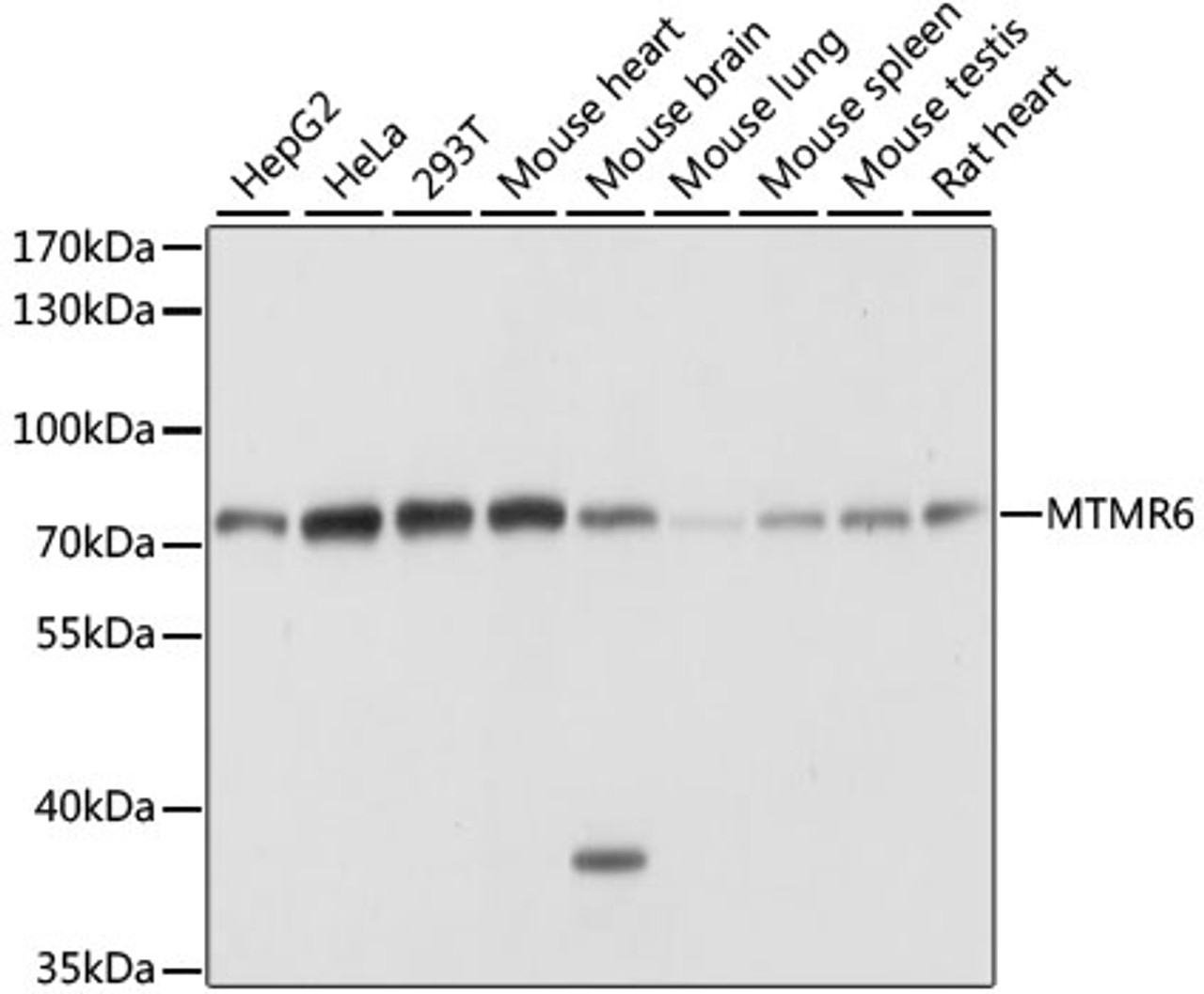 Western blot analysis of extracts of various cell lines using MTMR6 Polyclonal Antibody at dilution of 1:1000.