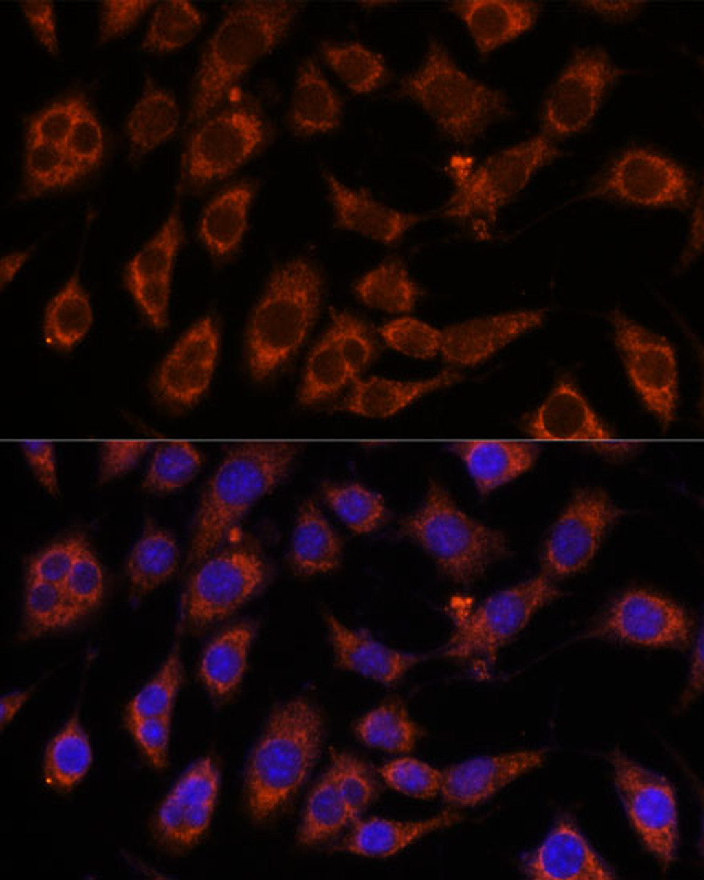 Immunofluorescence analysis of L929 cells using GFPT2 Polyclonal Antibody at dilution of  1:100. Blue: DAPI for nuclear staining.