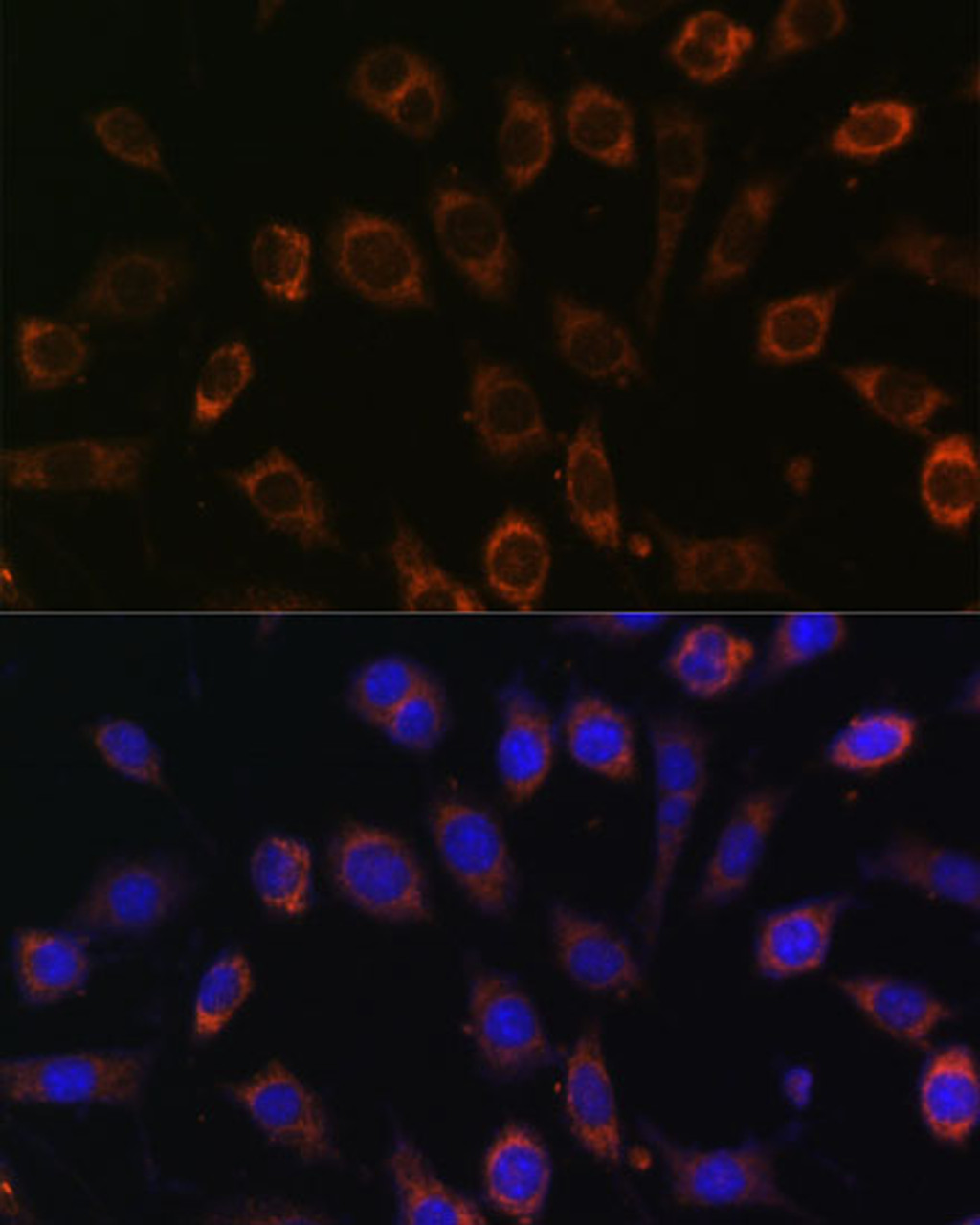 Immunofluorescence analysis of L929 cells using TCIRG1 Polyclonal Antibody at dilution of  1:100 (40x lens). Blue: DAPI for nuclear staining.