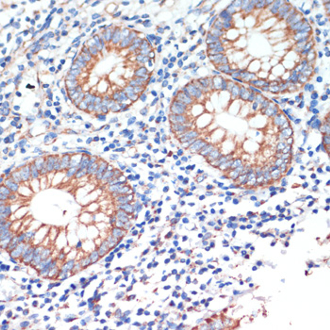 Immunohistochemistry of paraffin-embedded Human appendix using AFG3L2 Polyclonal Antibody at dilution of  1:200 (40x lens).