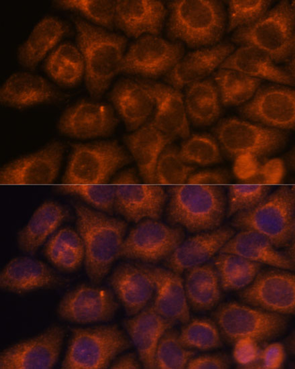 Immunofluorescence analysis of HeLa cells using SEC23IP Polyclonal Antibody at dilution of  1:100. Blue: DAPI for nuclear staining.