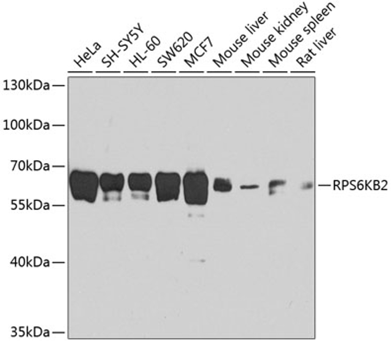 Western blot analysis of extracts of various cell lines using RPS6KB2 Polyclonal Antibody at dilution of 1:1000.