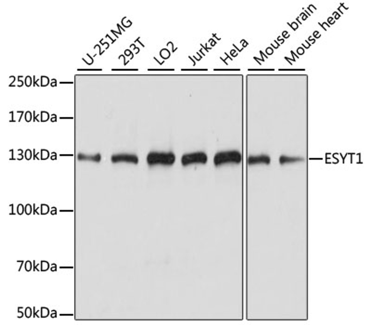 Western blot analysis of extracts of various cell lines using ESYT1 Polyclonal Antibody at dilution of 1:1000.