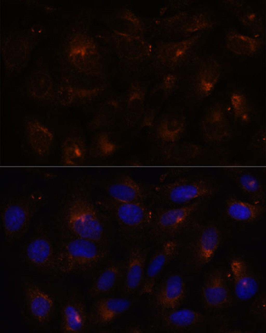 Immunofluorescence analysis of U-2 OS cells using ESYT1 Polyclonal Antibody at dilution of  1:100. Blue: DAPI for nuclear staining.
