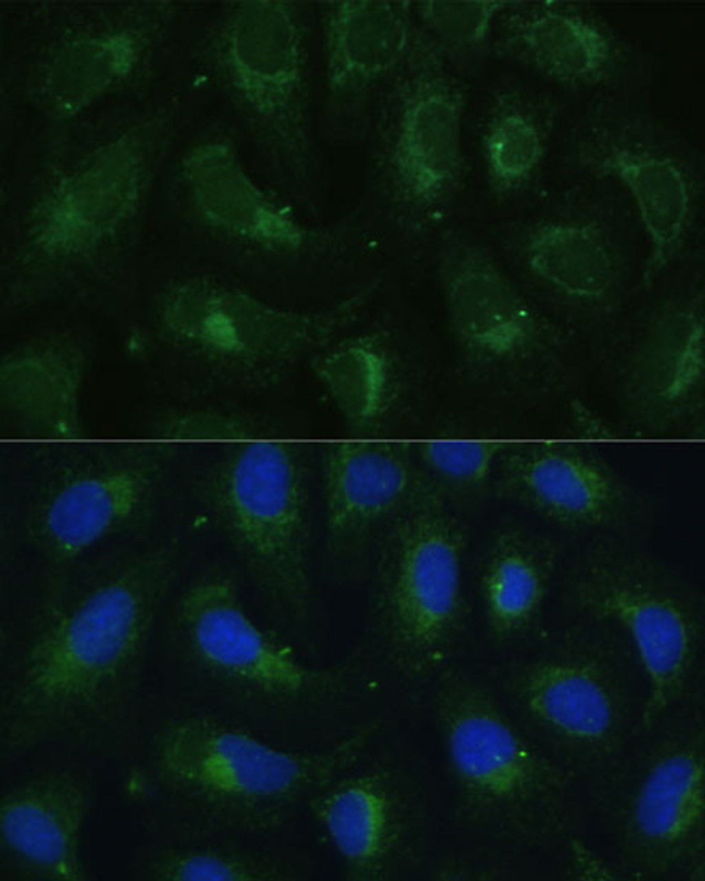 Immunofluorescence analysis of U-2 OS cells using SULT1C4 Polyclonal Antibody at dilution of  1:100. Blue: DAPI for nuclear staining.