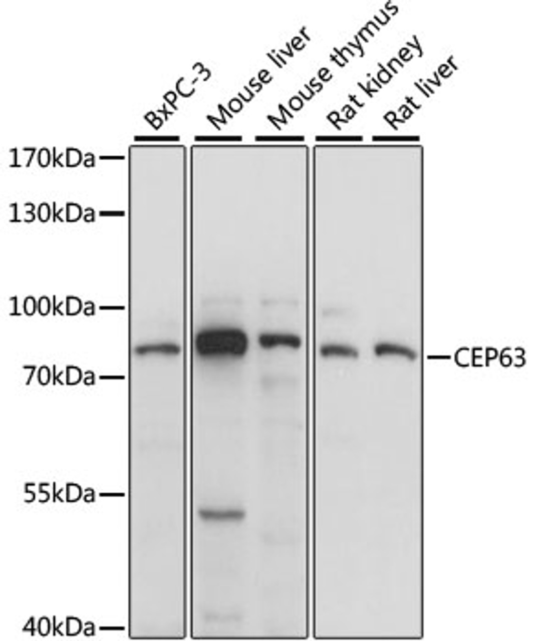 Western blot analysis of extracts of various cell lines using CEP63 Polyclonal Antibody at dilution of 1:1000.