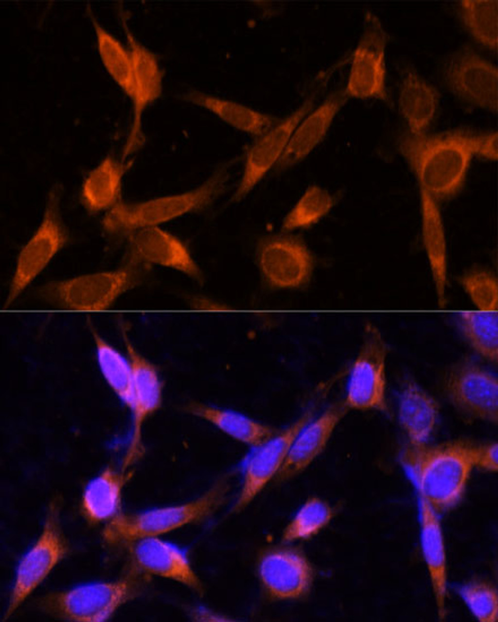 Immunofluorescence analysis of NIH-3T3 cells using VMP1 Polyclonal Antibody at dilution of  1:100 (40x lens). Blue: DAPI for nuclear staining.