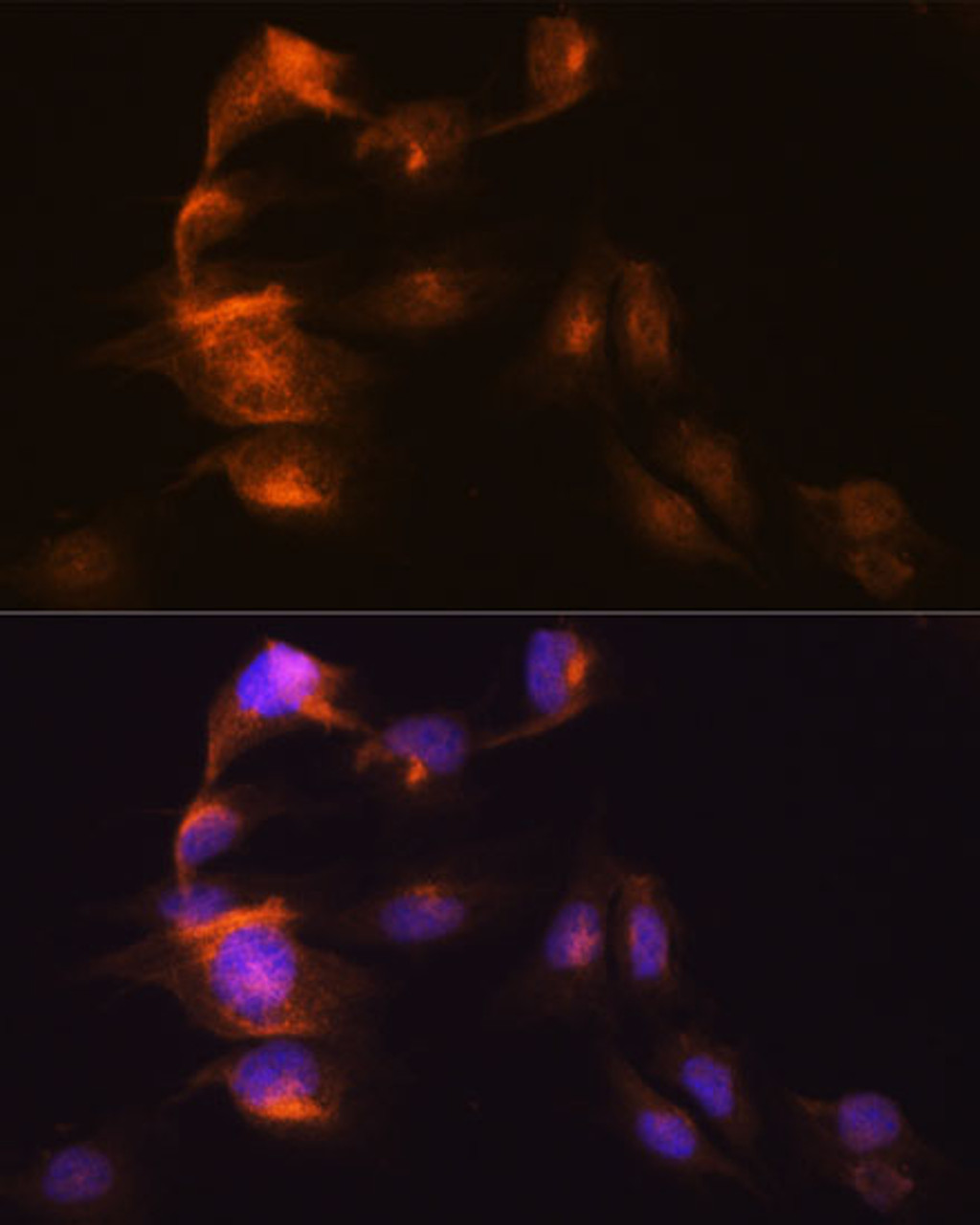 Immunofluorescence analysis of C6 cells using HOPX Polyclonal Antibody at dilution of  1:100. Blue: DAPI for nuclear staining.