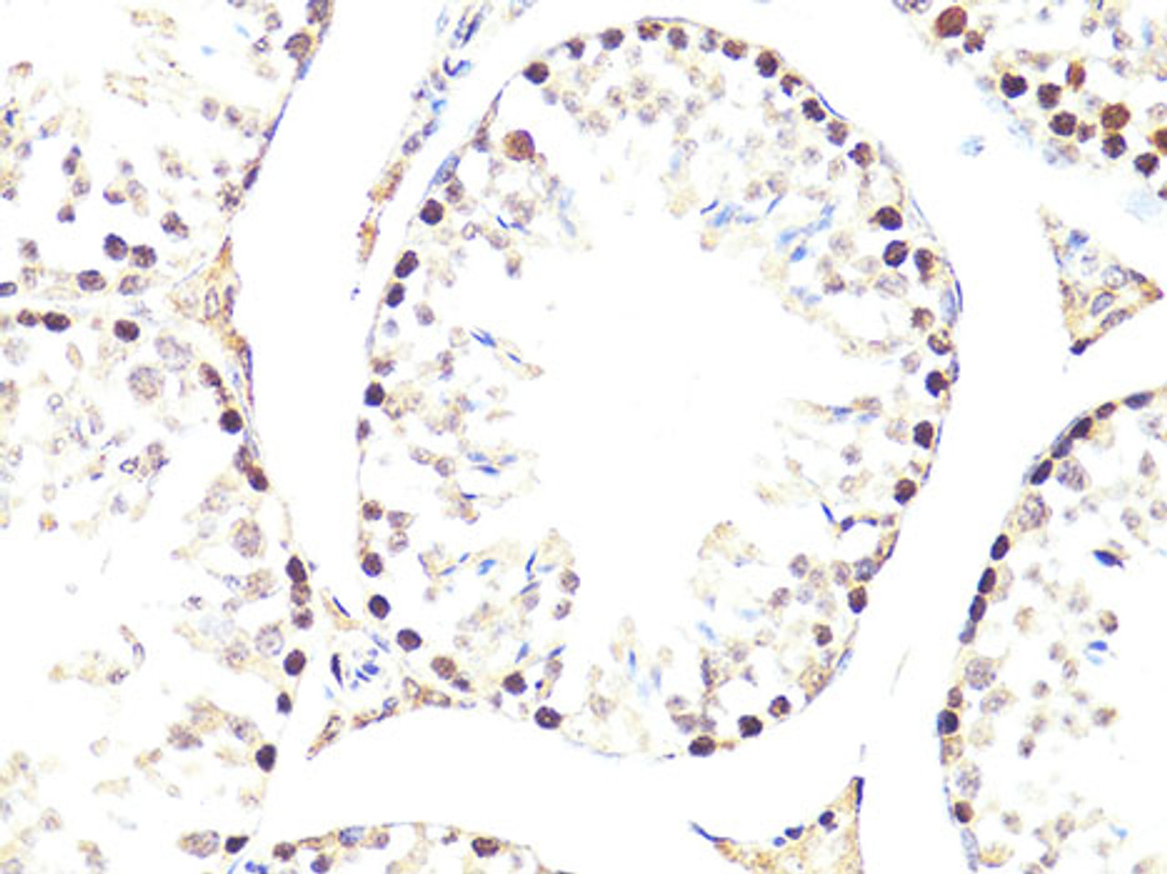 Immunohistochemistry of paraffin-embedded Mouse testis using Twist Polyclonal Antibody at dilution of  1:100 (40x lens).
