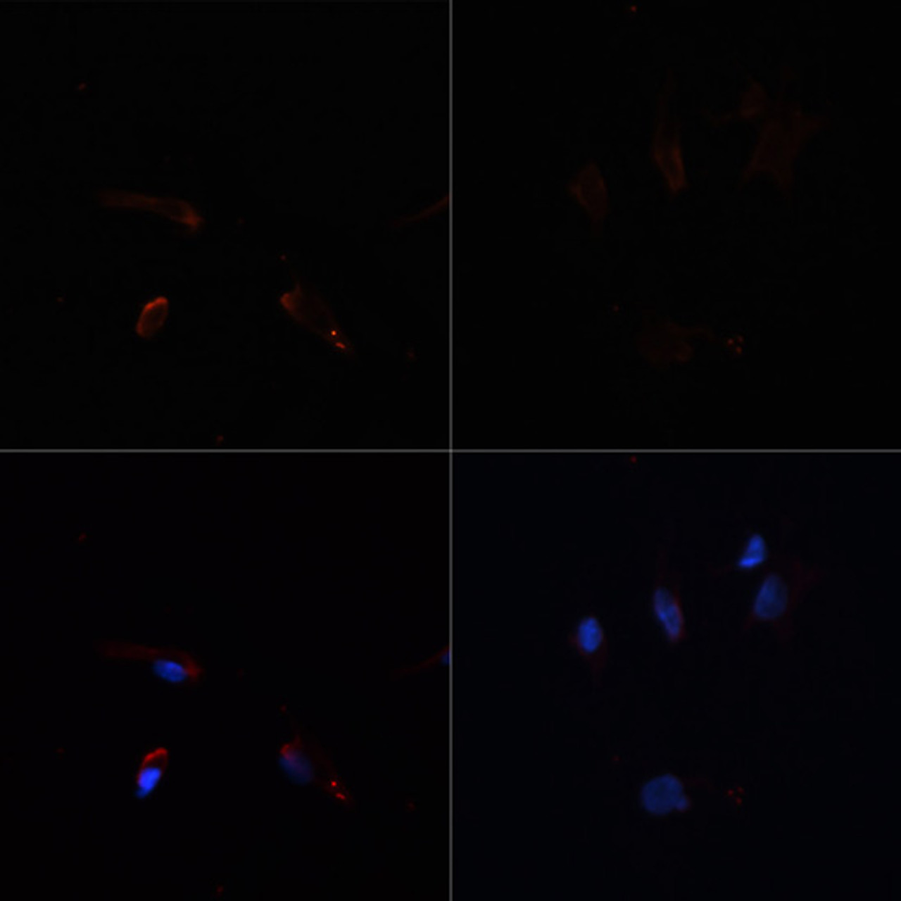 Immunofluorescence analysis of C6 cells using ACACA Polyclonal Antibody at dilution of  1:100. C6 cells were treated by Hydrogen Peroxide (2 nM) at 37℃ for 15 minutes after serum-starvation overnight(left). Blue: DAPI for nuclear staining.