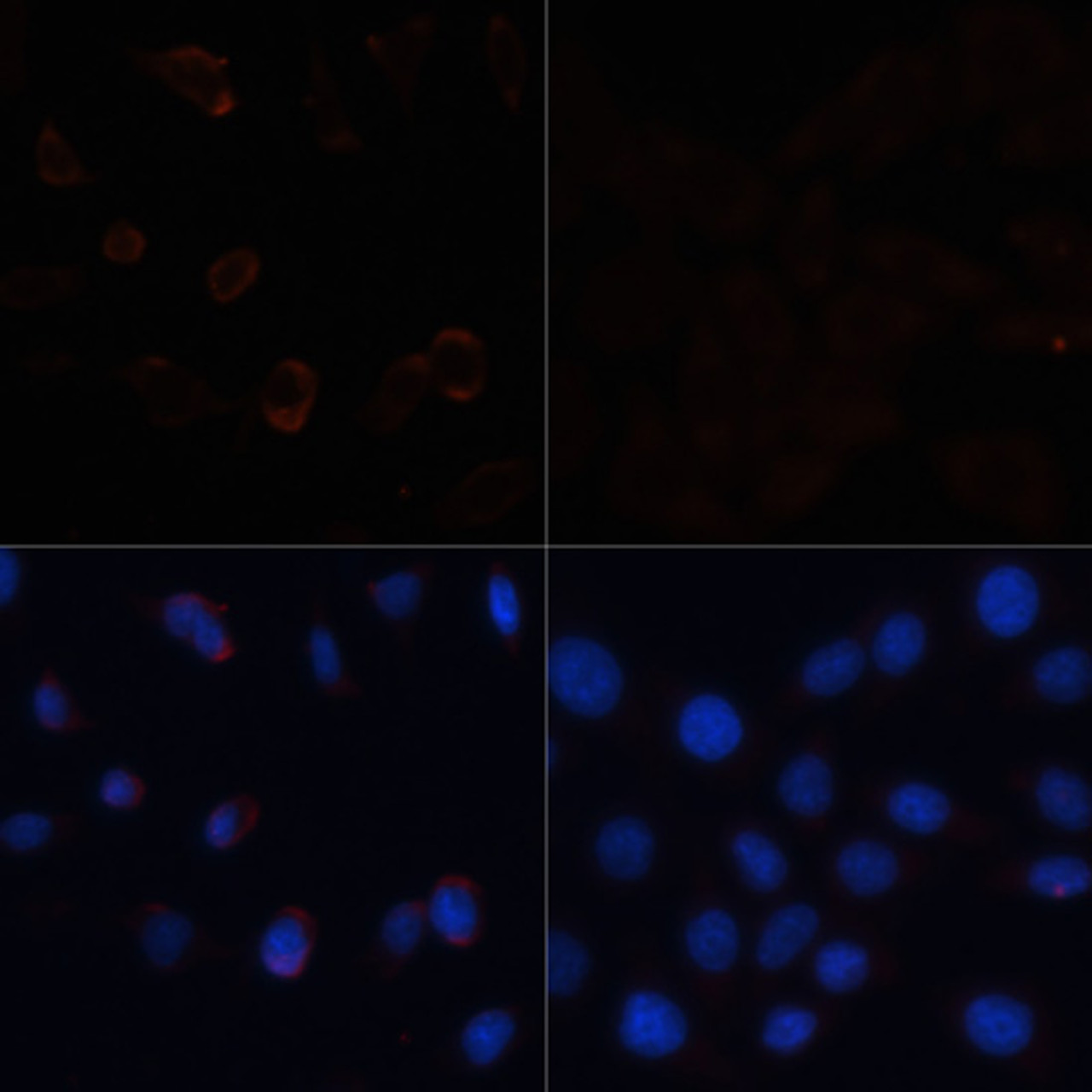 Immunofluorescence analysis of HeLa cells using ACACA Polyclonal Antibody at dilution of  1:100. HeLa cells were treated by Hydrogen Peroxide (2 nM) at 37℃ for 15 minutes after serum-starvation overnight(left). Blue: DAPI for nuclear staining.