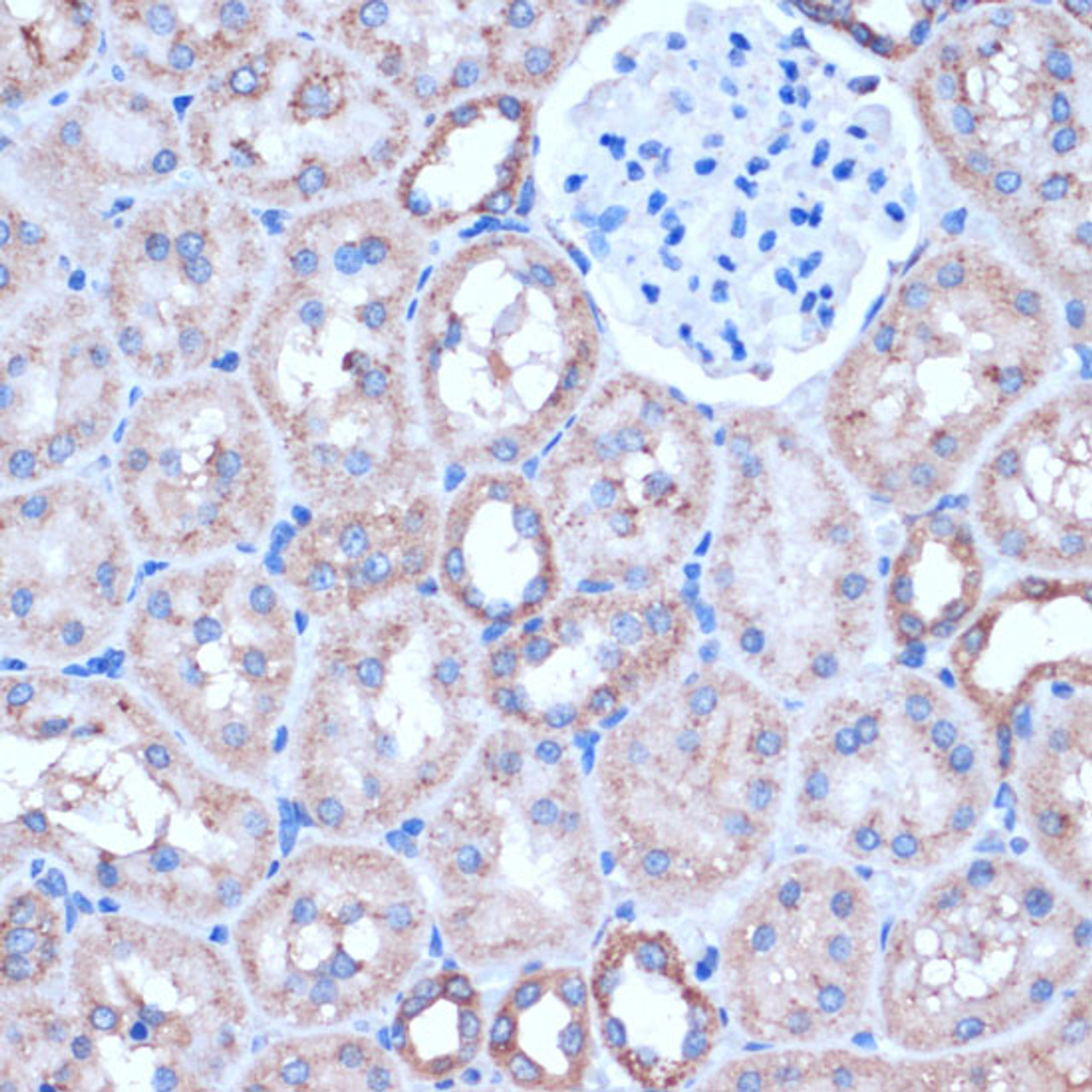 Immunohistochemistry of paraffin-embedded Rat kidney using ITCH Polyclonal Antibody at dilution of  1:50 (40x lens).