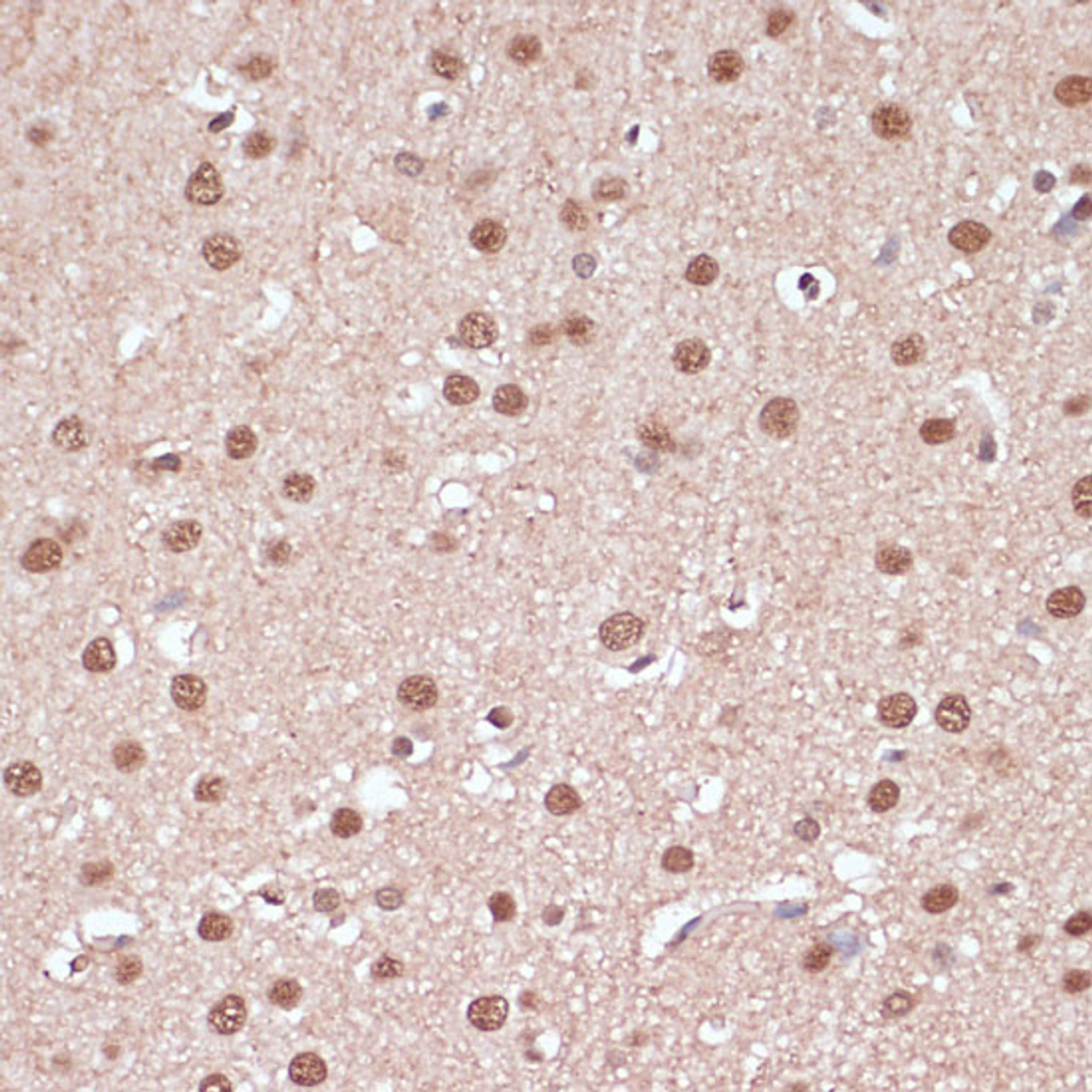 Immunohistochemistry of paraffin-embedded Rat brain using ITCH Polyclonal Antibody at dilution of  1:100 (40x lens).