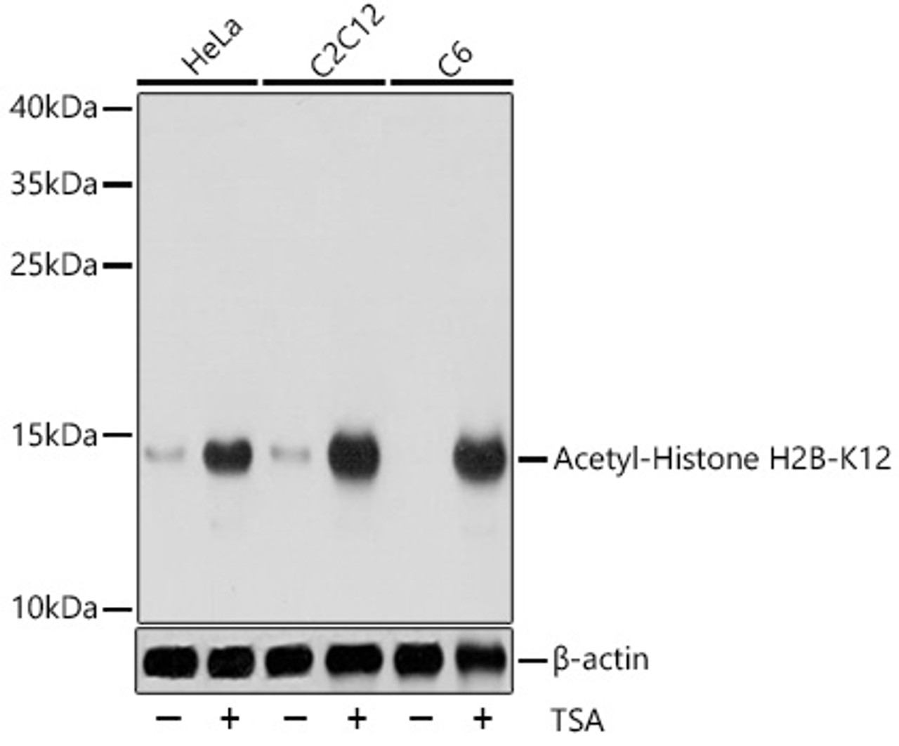 Western blot analysis of extracts of various cell lines using Acetyl-Histone H2B-K12 Polyclonal Antibody at dilution of 1:1000. HeLa cells were treated by TSA (1 uM) at 37°C for 18 hours. C2C12 cells were treated by TSA (1 uM) at 37°C for 18 hours. C6 cells were treated by TSA (1 uM) at 37°C for 18 hours.