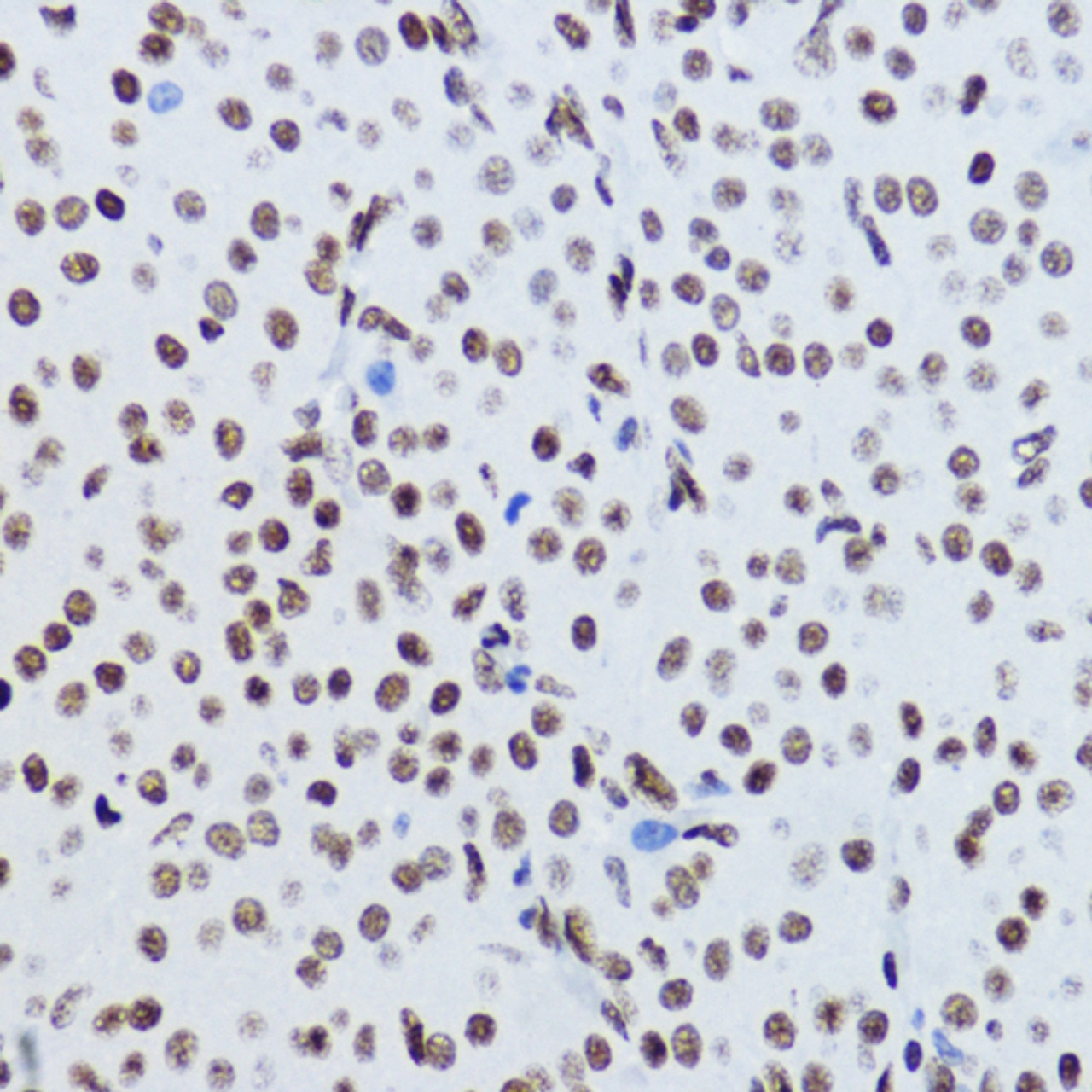 Immunohistochemistry of paraffin-embedded Rat ovary using Acetyl-Histone H2B-K12 Polyclonal Antibody at dilution of  1:200 (40x lens).