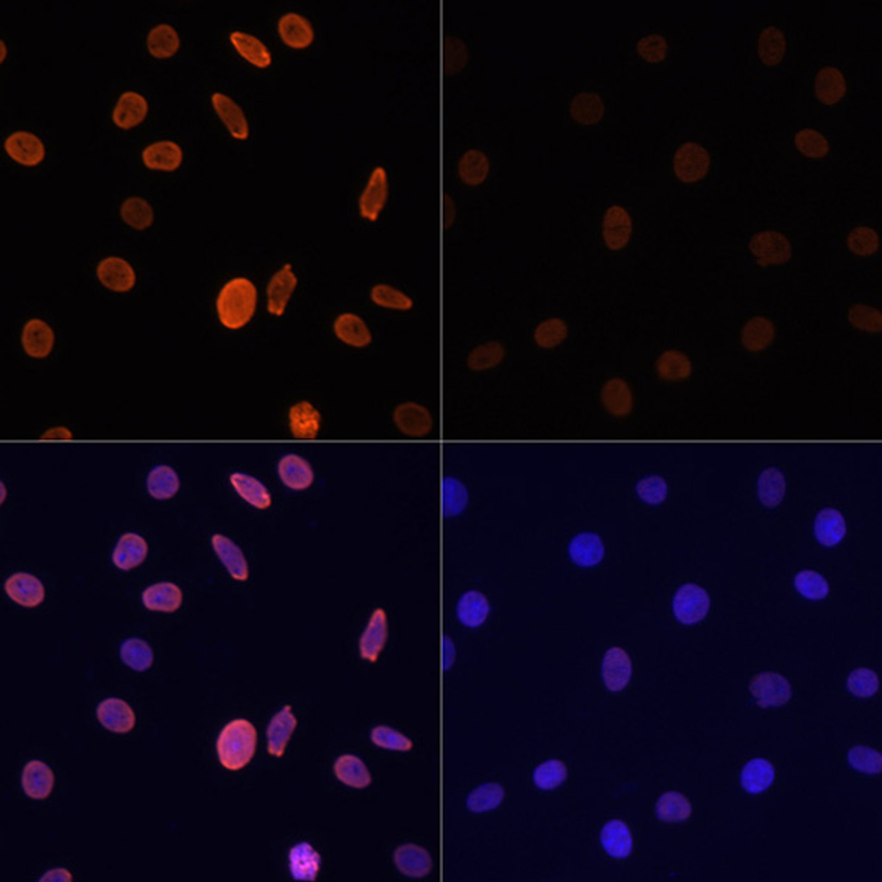 Immunofluorescence analysis of C6 cells using Acetyl-Histone H2B-K12 Polyclonal Antibody at dilution of  1:100.C6 cells were treated by TSA (1 uM) at 37℃ for 18 hours. Blue: DAPI for nuclear staining.