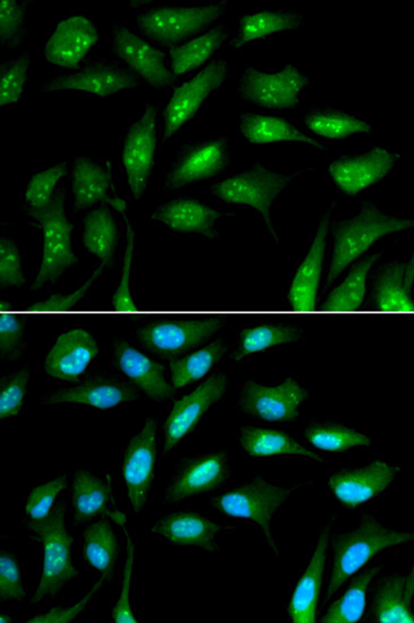 Immunofluorescence analysis of MCF-7 cells using beta 2 Microglobulin Polyclonal Antibody